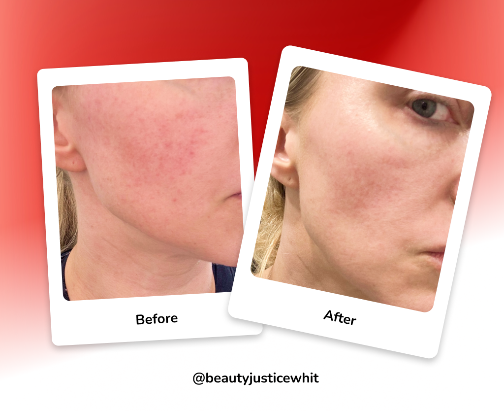 Before And After Polaroid Cards